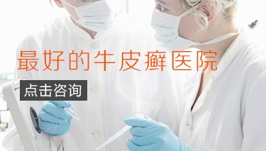 郑州哪家医院是专业治疗牛皮癣
